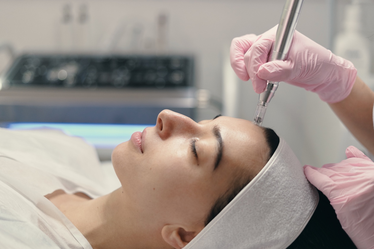 Microneedling Gesichtsbehandlung Stuttgart